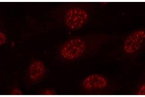Immunofluorescence analysis of methanol-fixed HeLa cells using Phospho-MAPKAPK2(T334) Polyclonal Antibody (MAPKAP Kinase 2 抗体  (pThr334))