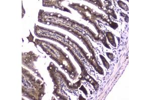 IHC testing of FFPE mouse small intestine tissue with Glutathione Reductase antibody at 1ug/ml. (Glutathione Reductase 抗体)
