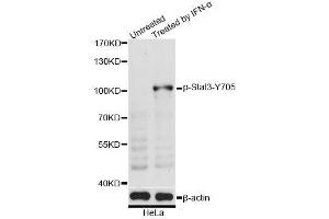 Western blot analysis of extracts of HeLa cells, using Phospho-Stat3-Y705 antibody (ABIN5969916) at 1/2000 dilution. (STAT3 抗体  (pTyr705))