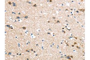 The image on the left is immunohistochemistry of paraffin-embedded Human brain tissue using ABIN7190906(HAUS7 Antibody) at dilution 1/30, on the right is treated with synthetic peptide. (HAUS7 抗体)