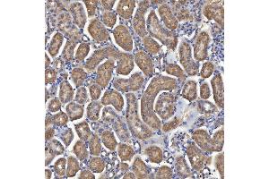 IHC analysis of Mitochondrial Dicarboxylate Carrier/SLC25A10 using anti-Mitochondrial Dicarboxylate Carrier/SLC25A10 antibody (ABIN7601497).