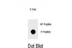 Dot blot analysis of Phospho-IKKB- Antibody Phospho-specific Pab (ABIN1539709 and ABIN2839874) on nitrocellulose membrane. (IKBKB 抗体  (pSer675))