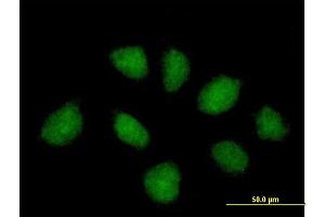 Immunofluorescence of purified MaxPab antibody to C1orf164 on HeLa cell. (RNF220 抗体  (AA 1-566))