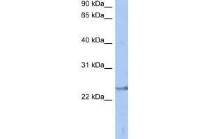 Western Blotting (WB) image for anti-ATPase, H+ Transporting, Lysosomal 31kDa, V1 Subunit E2 (ATP6V1E2) (Middle Region) antibody (ABIN2787752)