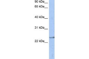 WB Suggested Anti-ATP6V1E2 Antibody Titration: 0. (ATP6V1E2 抗体  (Middle Region))