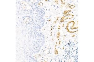 Immunohistochemistry of paraffin-embedded human colon using Decorin Rabbit pAb (ABIN3022360, ABIN3022361, ABIN3022362, ABIN1512816 and ABIN6218761) at dilution of 1:50 (40x lens). (Decorin 抗体  (AA 31-359))
