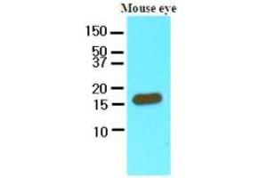 Western Blotting (WB) image for anti-Cellular Retinoic Acid Binding Protein 2 (CRABP2) (AA 1-138), (N-Term) antibody (ABIN356225) (CRABP2 抗体  (N-Term))