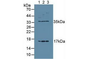 Western blot analysis of (1) Human Placenta Tissue, (2) Human PC-3 Cells and (3) Human MCF7 Cells. (Ki-67 抗体  (AA 3088-3235))