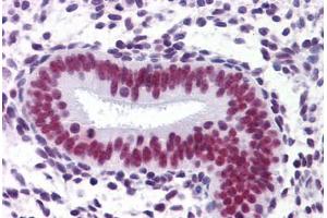 Uterus: Formalin-Fixed, Paraffin-Embedded (FFPE)