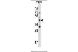 Western blot analysis of RBM42 Antibody (C-term) in CEM cell line lysates (35ug/lane).