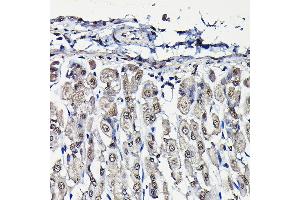Immunohistochemistry of paraffin-embedded mouse stomach using PFKFB3 Rabbit pAb (ABIN6129841, ABIN6145485, ABIN6145487 and ABIN6222692) at dilution of 1:25 (40x lens). (PFKFB3 抗体  (AA 400-500))
