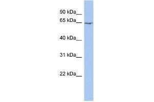 WB Suggested Anti-MYEF2 Antibody Titration:  0. (MYEF2 抗体  (N-Term))