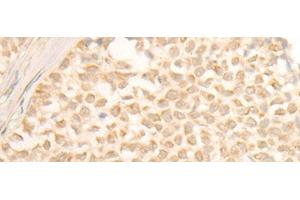 Immunohistochemistry (Paraffin-embedded Sections) (IHC (p)) image for anti-Cytochrome P450, Family 4, Subfamily X, Polypeptide 1 (CYP4X1) antibody (ABIN7252450)