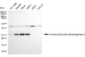 Western blotting analysis using 3-hydroxybutyrate dehydrogenase 2 antibody (ABIN7797419).
