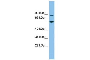 VPS52 antibody used at 1 ug/ml to detect target protein. (VPS52 抗体)