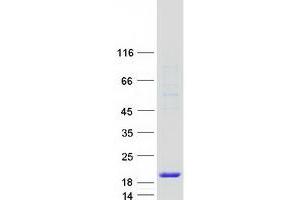 Western Blotting (WB) image for Golgin A7 (GOLGA7) (Transcript Variant 1) protein (Myc-DYKDDDDK Tag) (ABIN2722121)