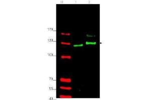 Western blot using  affinity purified anti-Gli-2 antibody shows detection of Gli-2 protein in rat testes (lane 1) and human HEK293 (lane 2) whole cell lysates (arrowhead). (GLI2 抗体  (Internal Region))