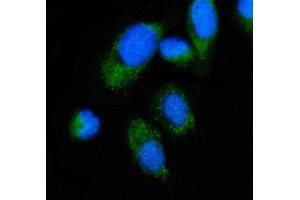 IF analysis of ALAS2/ASB using anti-ALAS2/ASB antibody (ABIN7599056). (ALAS2 抗体  (AA 1-190))