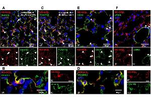 NO-GC expression in the murine lung. (Desmin 抗体  (C-Term))
