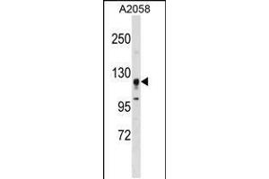 Western blot analysis in A2058 cell line lysates (35ug/lane). (STK31 抗体  (N-Term))