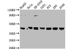 Western Blot Positive WB detected in: HepG2 whole cell lysate, Hela whole cell lysate, SH-SY5Y whole cell lysate, U251 whole cell lysate, PC-3 whole cell lysate, 293 whole cell lysate, A549 whole cell lysate All lanes: TPST1 antibody at 1:2000 Secondary Goat polyclonal to rabbit IgG at 1/50000 dilution Predicted band size: 43 kDa Observed band size: 43 kDa (TPST1 抗体  (AA 283-370))