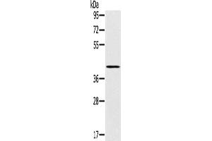 Gel: 8 % SDS-PAGE, Lysate: 40 μg, Lane: Mouse kidney tissue, Primary antibody: ABIN7192389(SLC14A1 Antibody) at dilution 1/200, Secondary antibody: Goat anti rabbit IgG at 1/8000 dilution, Exposure time: 2 minutes