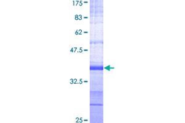 PRKAA2 Protein (AA 453-552) (GST tag)