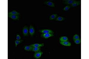Immunofluorescent analysis of HepG2 cells using ABIN7144333 at dilution of 1:100 and Alexa Fluor 488-congugated AffiniPure Goat Anti-Rabbit IgG(H+L) (SLPI 抗体  (AA 26-132))
