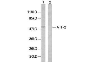 Western blot analysis of extracts from LOVO cells using ATF-2(Ab-69 or 51) antibody (E021030). (ATF2 抗体)