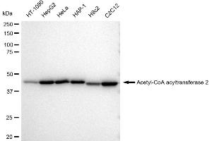 Western blotting analysis using Acetyl-CoA acyltransferase 2 antibody (ABIN7797441). (Recombinant ACAA2 抗体)