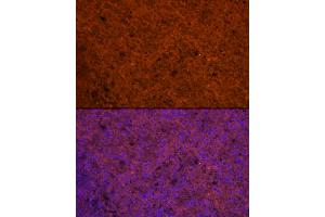 Immunofluorescence analysis of Human spleen using CCL5/RANTES antibody (ABIN6129369, ABIN6138063, ABIN6138065 and ABIN6218473) at dilution of 1:100. (CCL5 抗体  (AA 24-91))