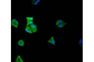 Immunofluorescence staining of Hela Cells with ABIN7127469 at 1:50, counter-stained with DAPI. (Recombinant EIF5A 抗体)