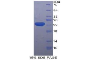 SDS-PAGE analysis of Human HMGCS Protein. (HMGCS1 蛋白)
