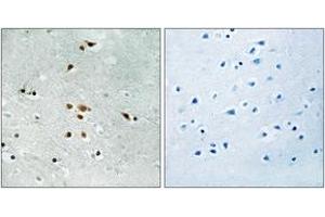 Immunohistochemistry analysis of paraffin-embedded human brain, using FER (Phospho-Tyr402) Antibody. (FER 抗体  (pTyr402))