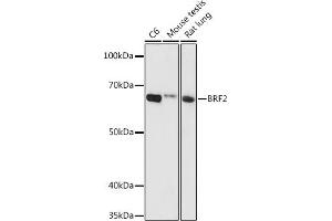 Western blot analysis of extracts of various cell lines, using BRF2 antibody (ABIN6129998, ABIN6137657, ABIN6137658 and ABIN6224790) at 1:1000 dilution. (BRF2 抗体  (AA 1-120))