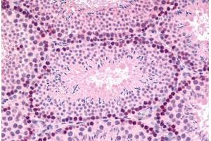 Mouse, Testis (formalin-fixed, paraffin-embedded) stained with GLI2 antibody ABIN214612 at 5 ug/ml followed by biotinylated goat anti-rabbit IgG secondary antibody ABIN481713, alkaline phosphatase-streptavidin and chromogen. (GLI2 抗体  (Internal Region))