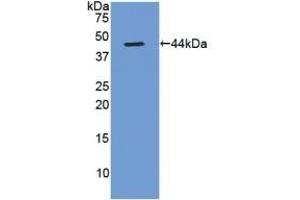 Detection of Recombinant Gastrin, Rat using Polyclonal Antibody to Gastrin (GT)
