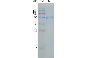 Human IL23A Protein, hFc Tag on SDS-PAGE under reducing condition.