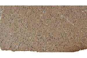 Immunohistochemistry (IHC) image for anti-Patched 1 (PTCH1) (C-Term) antibody (ABIN185521)