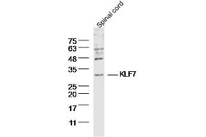 Mouse Spinal cord lysates probed with KLF7 Polyclonal Antibody, Unconjugated  at 1:300 dilution and 4˚C overnight incubation. (KLF7 抗体  (AA 131-210))