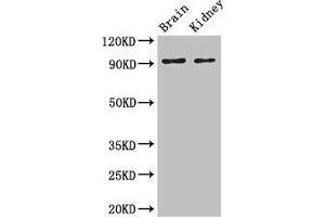 Western Blot Positive WB detected in: Mouse brain tissue, Mouse kidney tissue All lanes: SLC9A1 antibody at 3 μg/mL Secondary Goat polyclonal to rabbit IgG at 1/50000 dilution Predicted band size: 91, 62 kDa Observed band size: 91 kDa (SLC9A1 抗体  (AA 36-102))