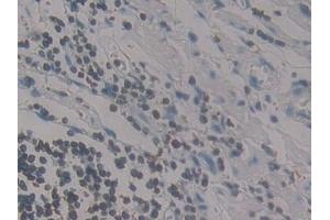 Immunohistochemistry (IHC) image for anti-Chemokine (C-C Motif) Ligand 13 (CCL13) (AA 24-98) antibody (ABIN7431335)