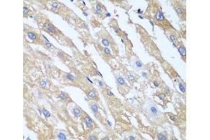 Immunohistochemistry of paraffin-embedded Human liver using PPP4R1 Polyclonal Antibody at dilution of 1:100 (40x lens). (PPP4R1 抗体)