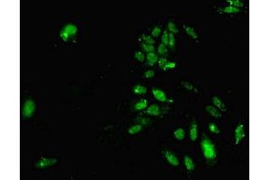 Immunofluorescent analysis of Hela cells using ABIN7155310 at dilution of 1:100 and Alexa Fluor 488-congugated AffiniPure Goat Anti-Rabbit IgG(H+L) (HDAC3 抗体  (AA 1-428))