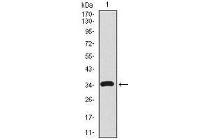 Western blot analysis using CD59 mAb against human CD59 recombinant protein. (CD59 抗体  (AA 31-111))