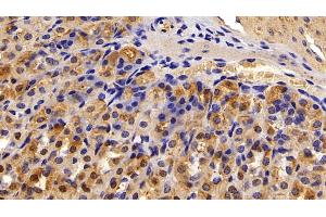 Immunohistochemistry (IHC) image for anti-Alanine Aminotransferase (ALT) (AA 143-417) antibody (ABIN7429412)