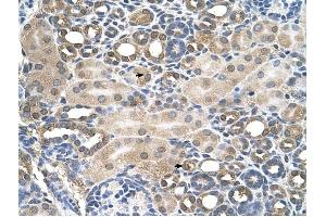 HFE antibody was used for immunohistochemistry at a concentration of 4-8 ug/ml to stain Epithelial cells of renal tubule (arrows) in Human Kidney. (HFE 抗体  (C-Term))