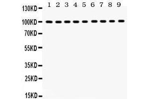 Western Blotting (WB) image for anti-Nuclear Receptor Subfamily 3, Group C, Member 1 (Glucocorticoid Receptor) (NR3C1) (AA 20-199) antibody (ABIN3043371) (Glucocorticoid Receptor 抗体  (AA 20-199))