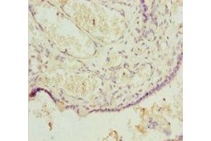 Immunohistochemistry of paraffin-embedded human placenta tissue using ABIN7164067 at dilution of 1:100 (POU4F3 抗体  (AA 1-180))