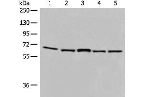 Western blot analysis of TM4 and 231 cell Mouse brain tissue Hela and HT-29 cell lysates using EHD1 Polyclonal Antibody at dilution of 1:500 (EHD1 抗体)